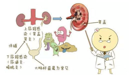 尿道刺痛尿频尿急灼热_尿刺痛尿频尿急怎么办_尿频尿急尿刺痛