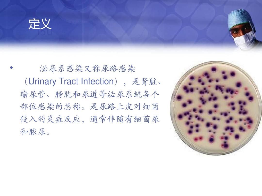 尿刺痛尿频尿急怎么办_尿频尿急尿刺痛_尿道刺痛尿频尿急灼热