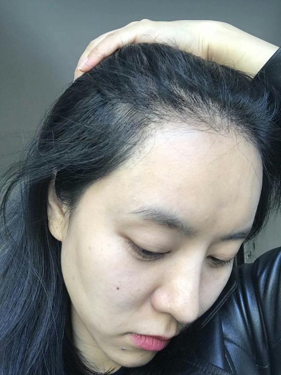 美图秀秀怎么修发际线_美图秀秀怎么修发际线_美图秀秀怎么修发际线