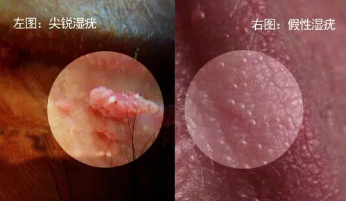 疣体游戏,探索奇幻世界的冒险之旅
