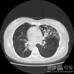 窦炎游戏,探索耳鼻喉健康新体验
